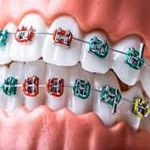 مراکز ارتودنسی