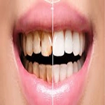 دندانپزشکی زیبایی